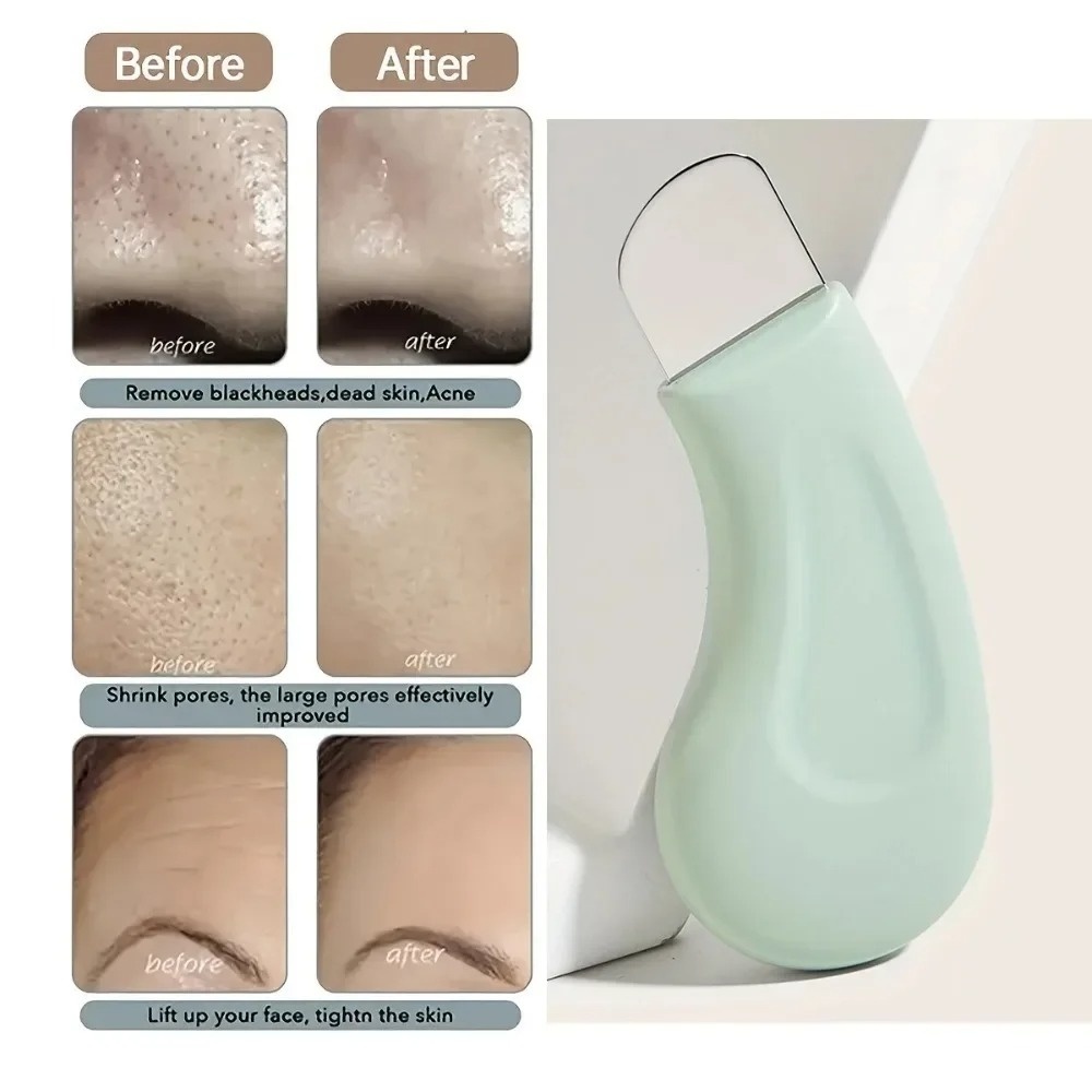 Deep Cleansing Blackhead White - Nasal Aspirator recension och pris