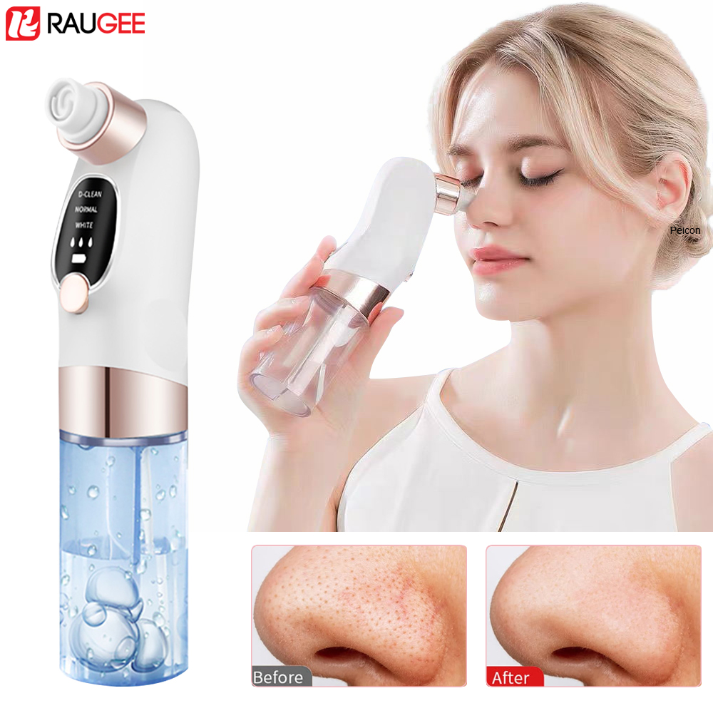 Blackhead Remover Electric Bla - Nasal Aspirator recension och pris