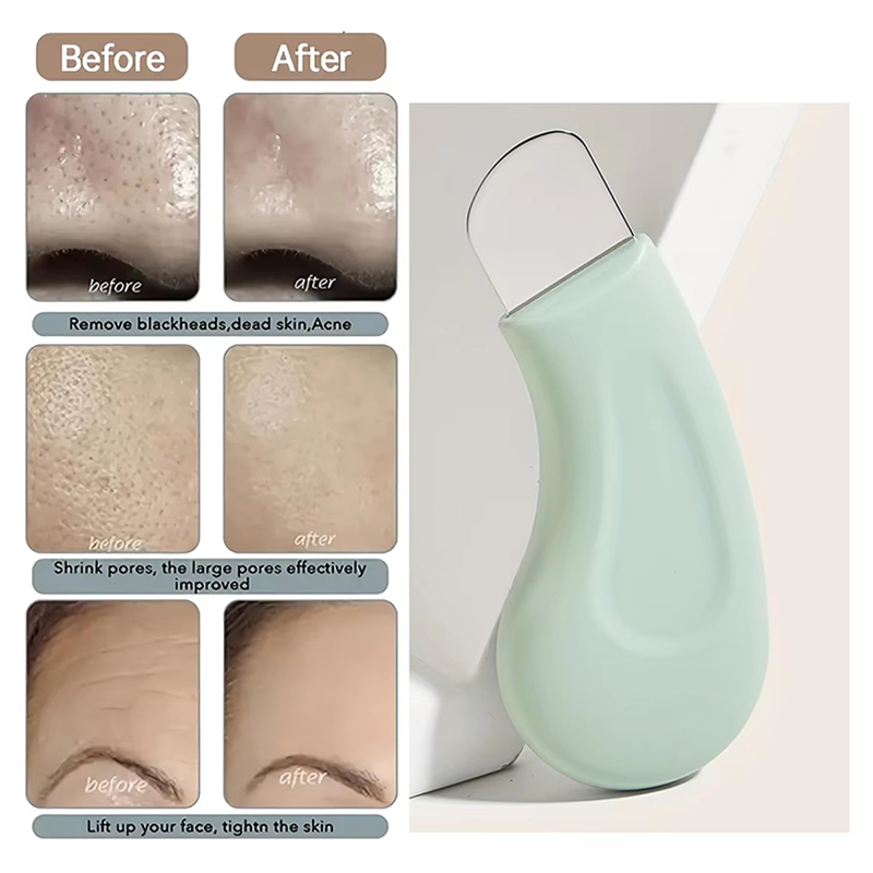 Deep Cleansing Facial Blackhea - Nasal Aspirator recension och pris